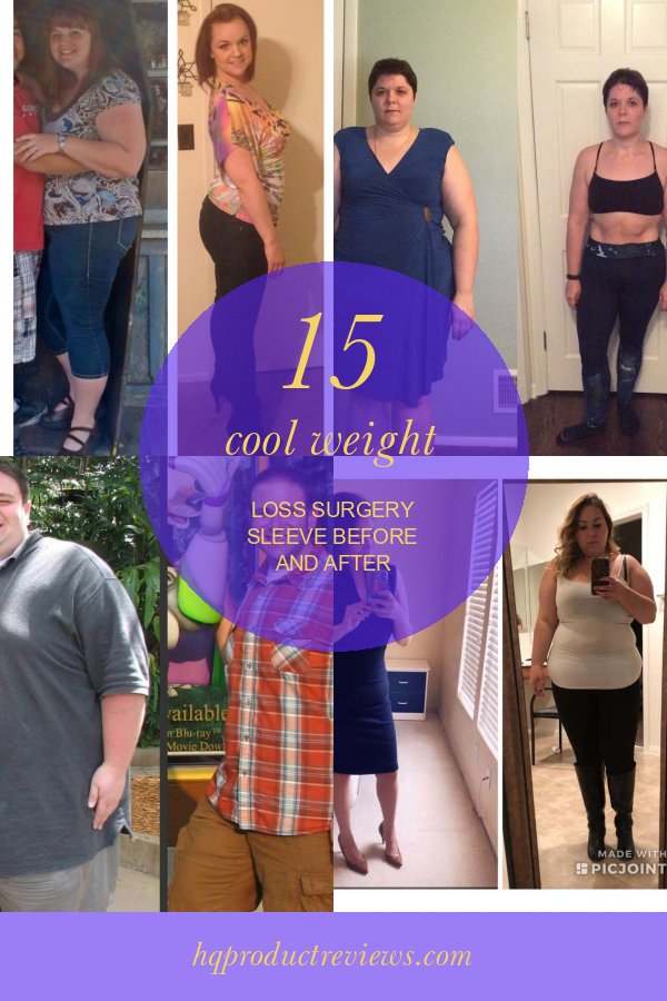 15 Cool Weight Loss Surgery Sleeve before and after Best Product Reviews